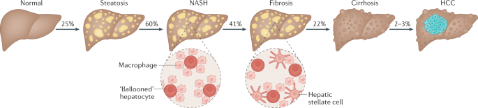 The pathological spectrum of NAFLD
